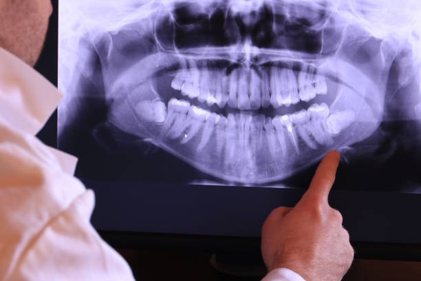 Best Emergency Care for Gum Disease in Crozet, VA