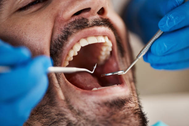 Best Walk-In Emergency Dental Services in Crozet, VA